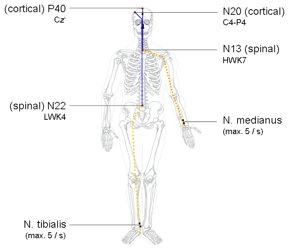 Diagram of the somatosensory evoked potential pathway